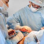 Weight Loss Surgery